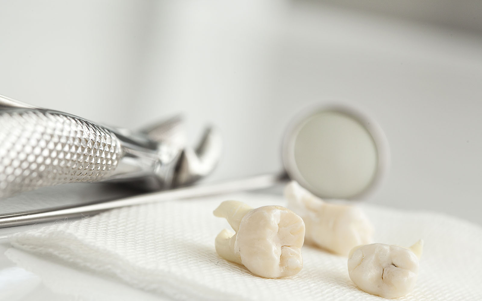 なぜ親知らず抜歯と虫歯治療は同時にできない？