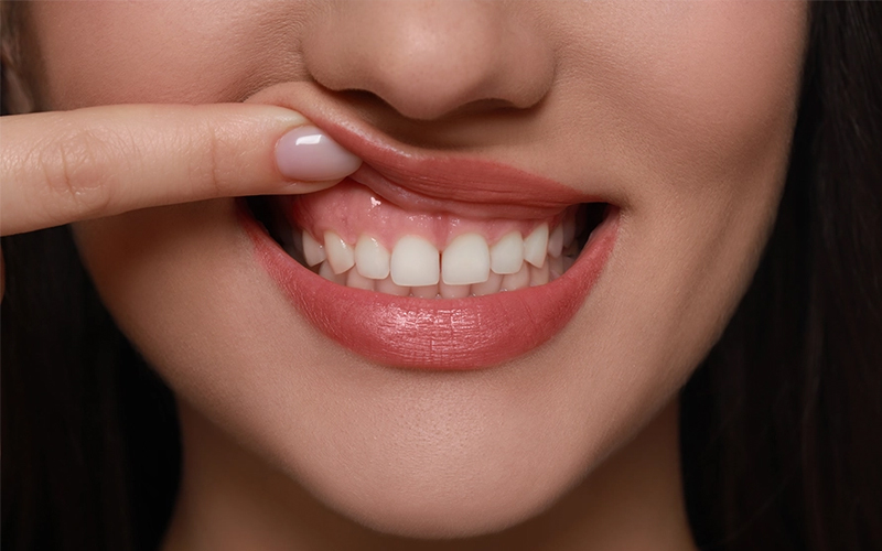 虫歯治療が痛くない方法（無痛治療）について