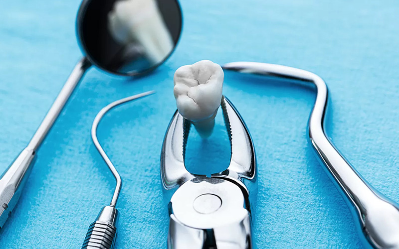 なぜ虫歯治療で薬を詰める？